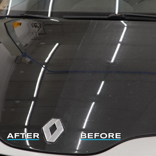 Before-After
